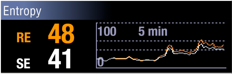 Entropy monitor displaying sudden peaks in RE during surgery
