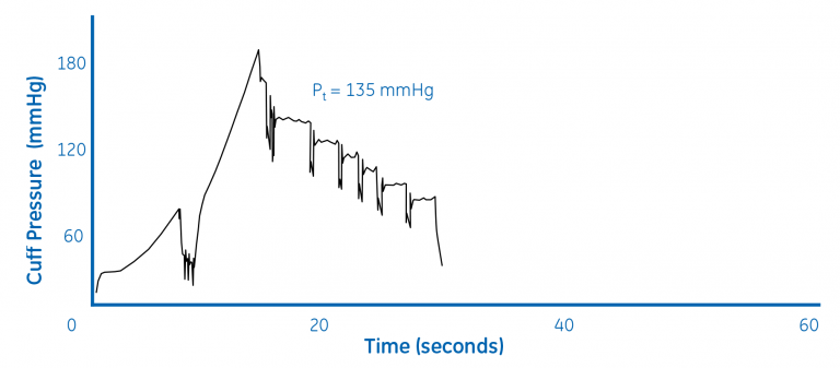 Figure 1b. Extrapolation of systolic pressure (BP = 145/89)