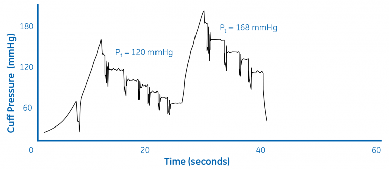 Figure 2. Repump sequence with DINAMAP SuperSTAT algorithm (BP = 147/87)