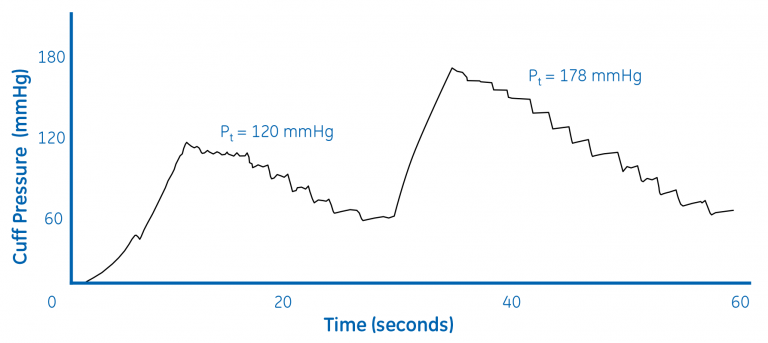 Figure 3. Repump sequence with Classic algorithm (BP= 141/82)