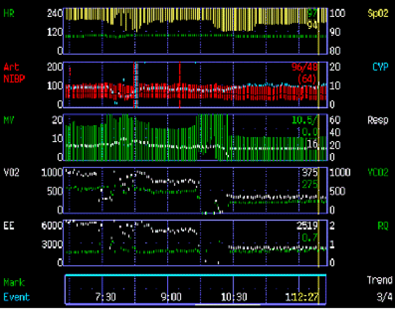 Screenshot of 40 year-old male respiratory monitor