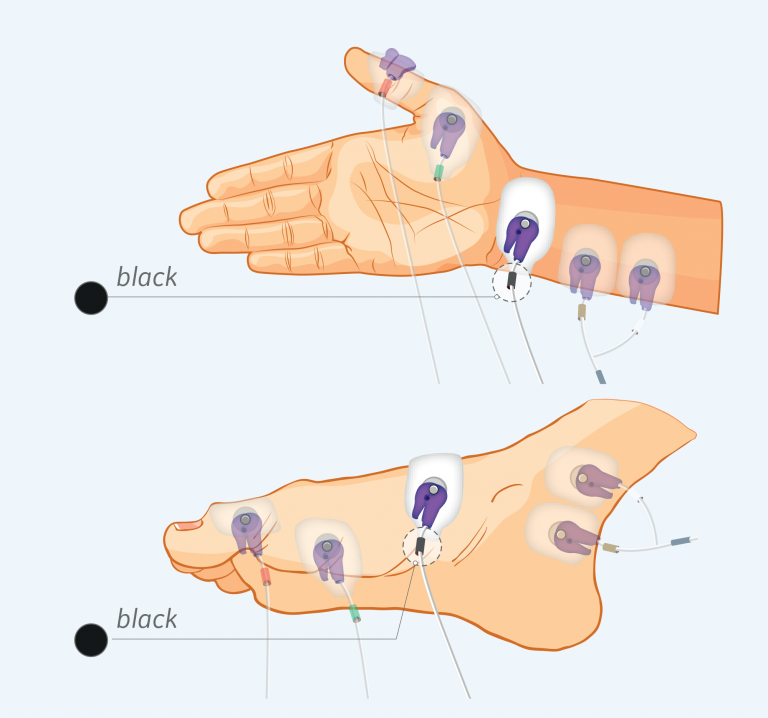 Figure 2: Reference sensor electrode