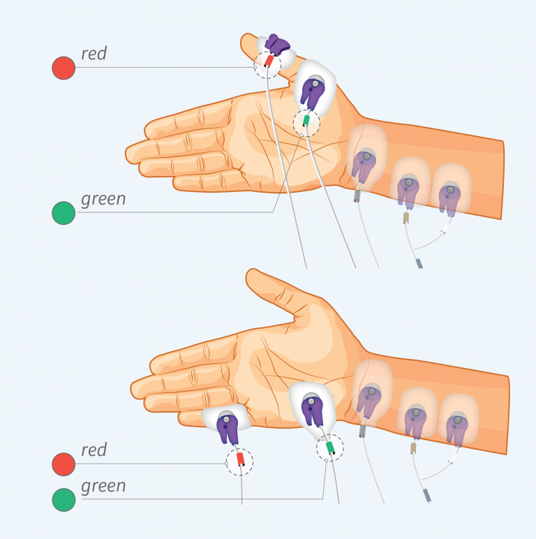 Figure 3: Measuring electrodes hand