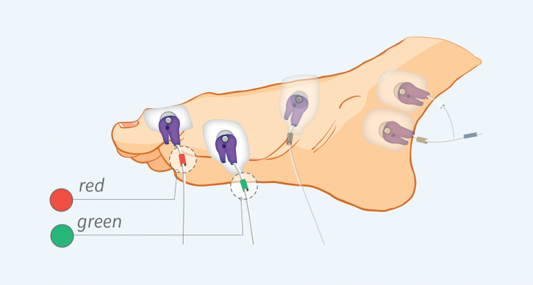 Figure 4: Measuring electrodes, foot