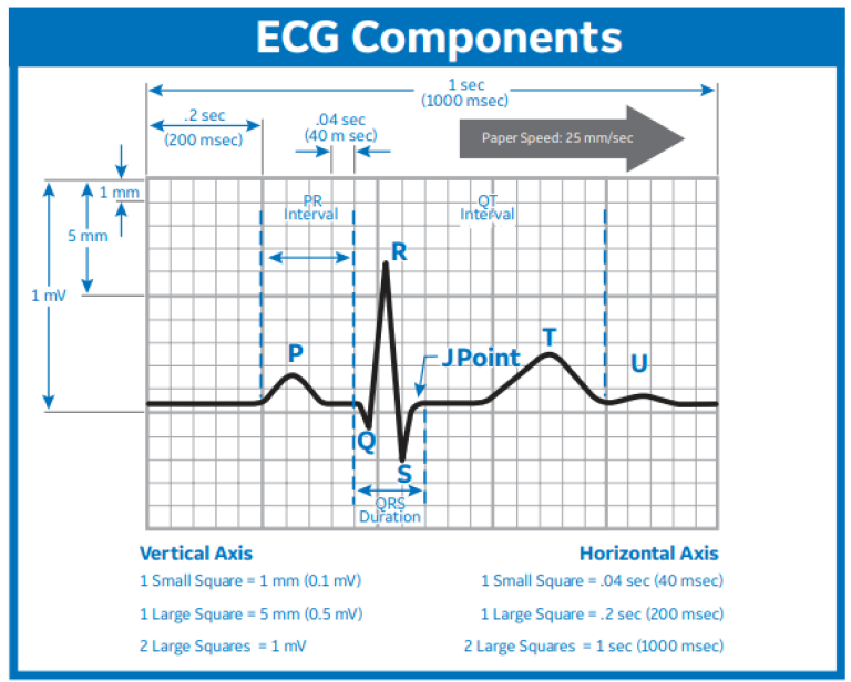 ECG Components