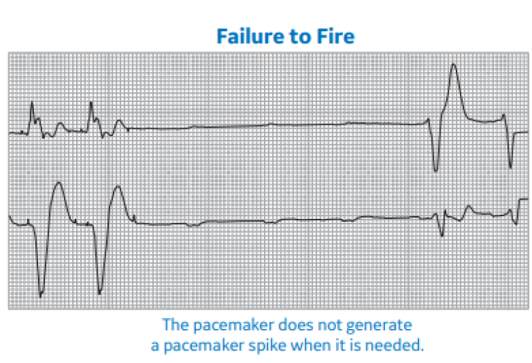 Failure to Fire