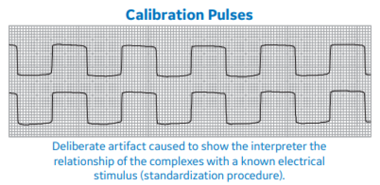 Calibration Pulses