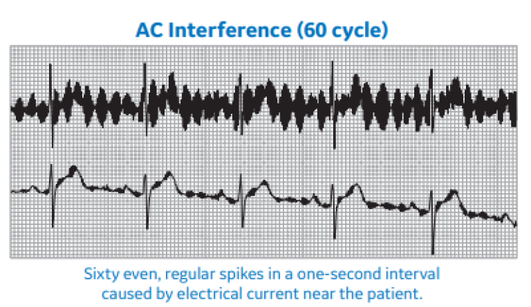 AC Interference (60 cycle)