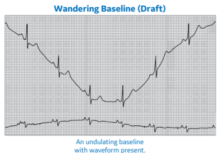 Wandering Baseline (Draft)