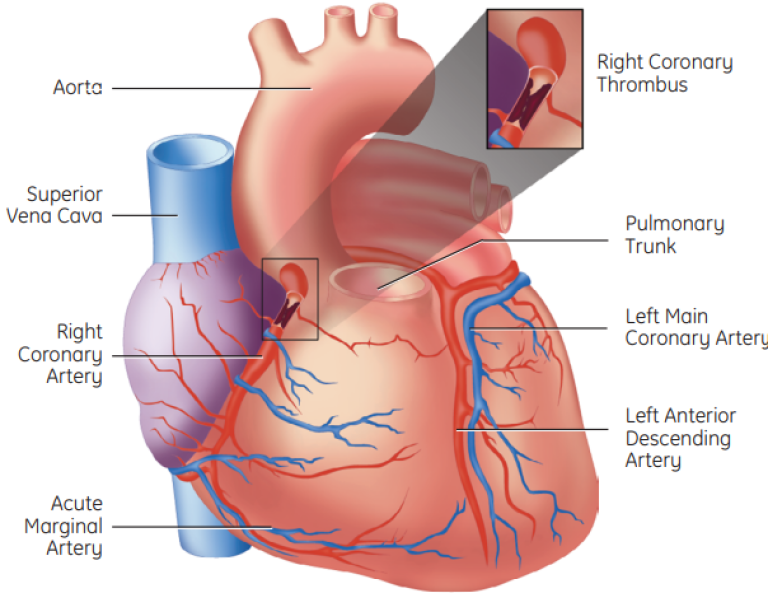 Anterior View of the heart