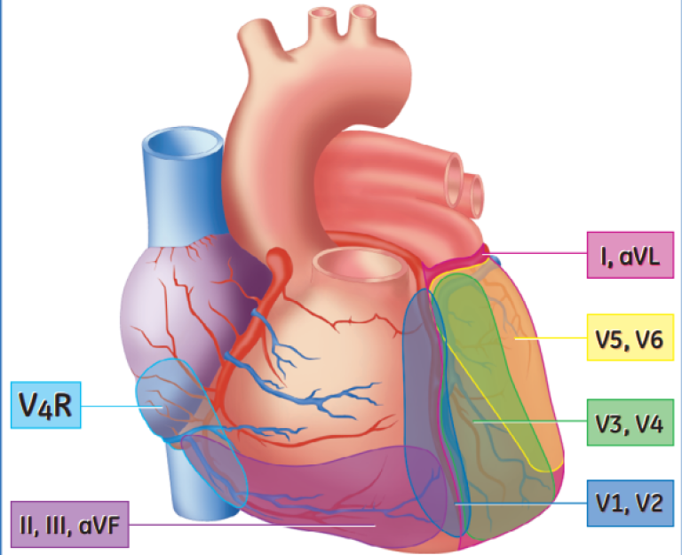 Anterior View of the heart with related ECG Leads