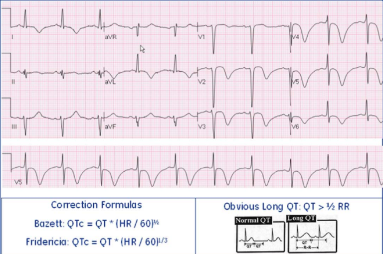 Heart Rate Correction