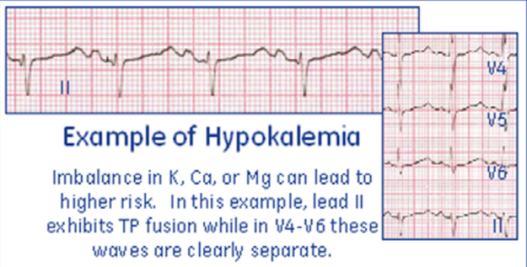 Electrolytes risk factor