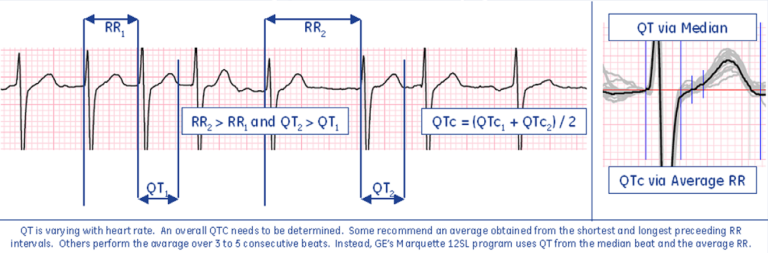 Calculating QTc in the Presence of Varying Heart Rate