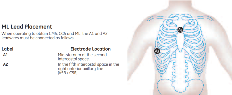ML Lead Placement