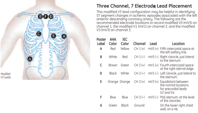 Three Channel, 7 Electrode Placement
