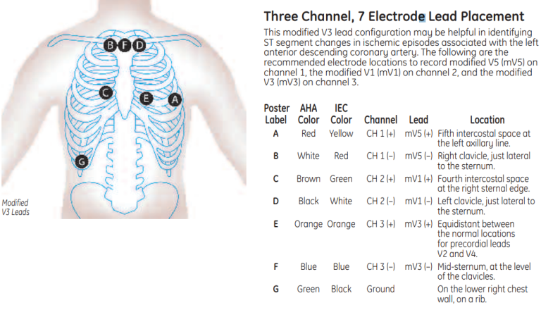 Diagnostic ECG Lead Placement | Clinical View