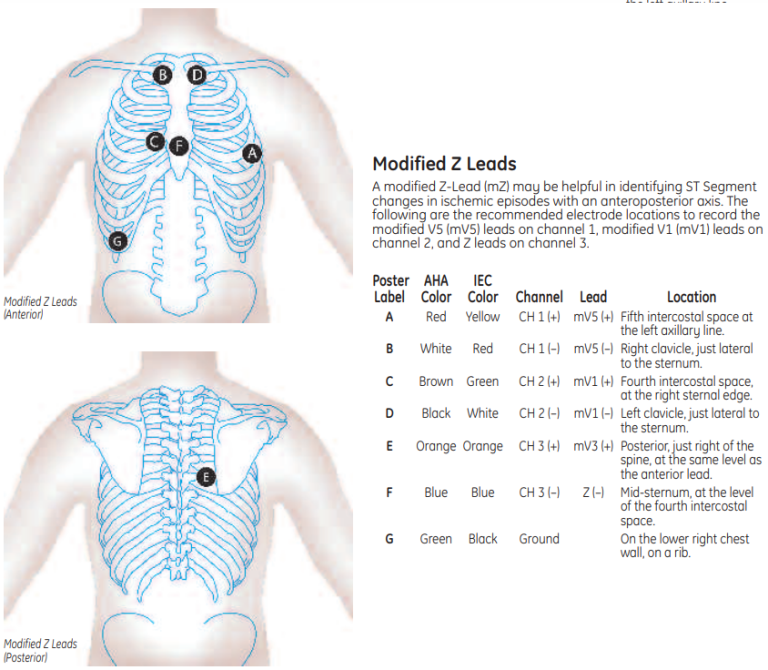 Modified Z leads