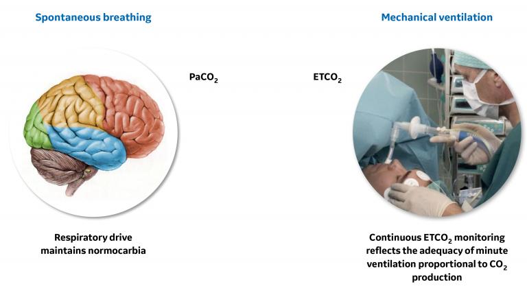 Differences in ventilation