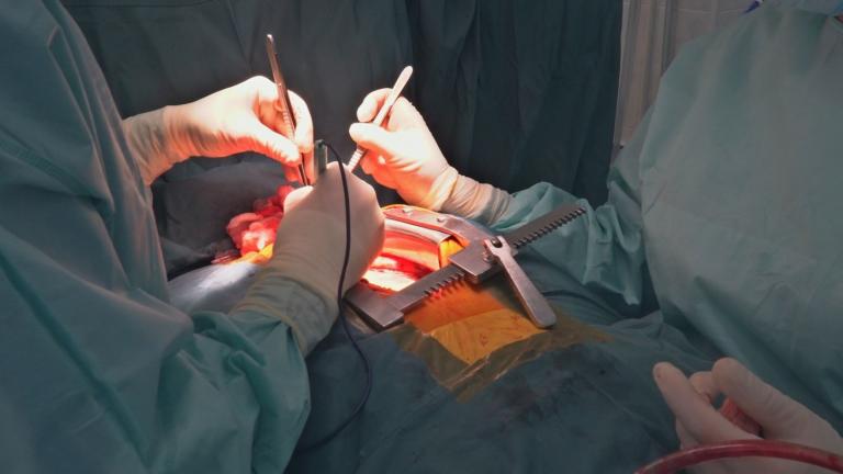 Two clinicians performing cardiopulmonary bypass surgery on a patient