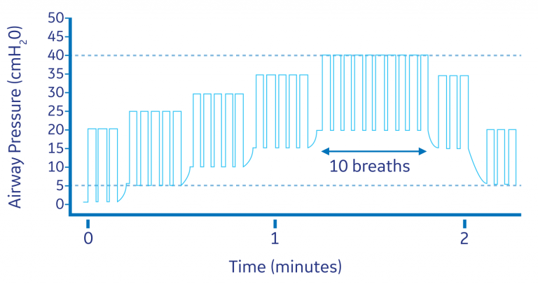 Changes in airway pressure with time