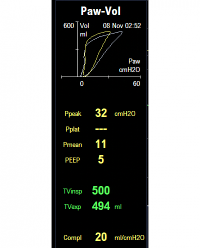 Paw-Vol screen