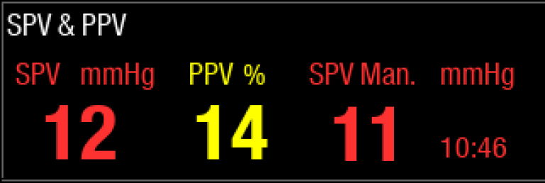 SPV & PPV screen