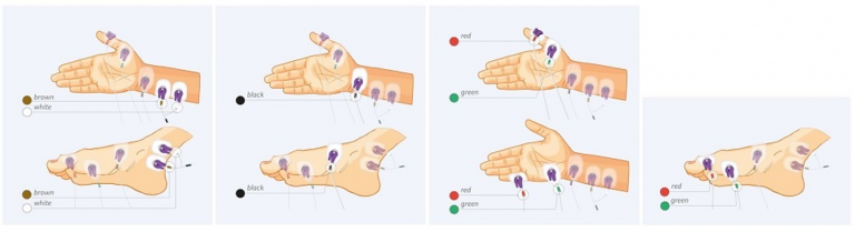 nmt sensor positioning