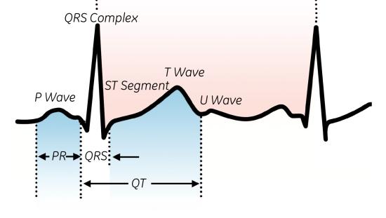 Determination of the QT interval