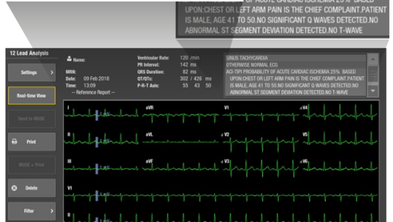 A view of a 12RL report on the monitor screen