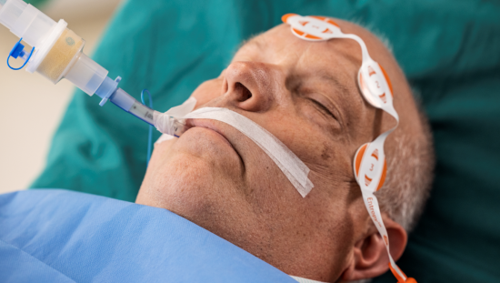 Patient under anesthesia with Entropy sensors