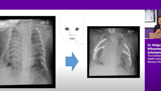Dr. Mikaszewska´s slides