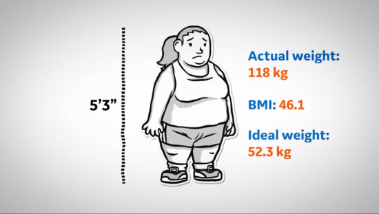 Morbid obese woman animation